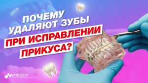 Для исправления прикуса приходится удалять зубы