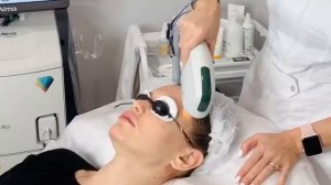 Фотоомоложение или лазерное омоложение?