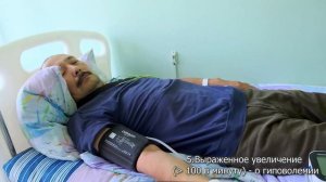 Выявление ортостатической гипотензии