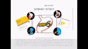 Де нол і Фосфалюгель