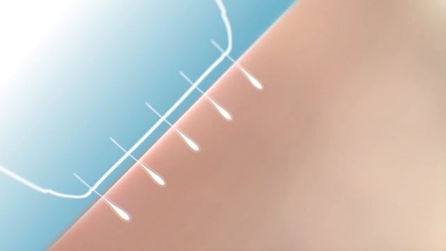 Фотоепілятор Philips Lumea SC2007 смотреть онлайн