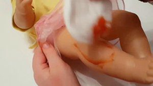 Baby-born упала и разбила коленку