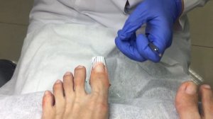 Мастер-класс по протезированию ногтей на ногах, по методике "Шаблон и Полимеры"