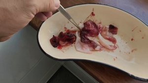 Оболочки эхинококка.