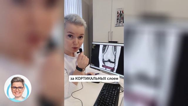 Вот, что будет, если посмотреть МРТ🧐! #ревматолог #лечениесуставов