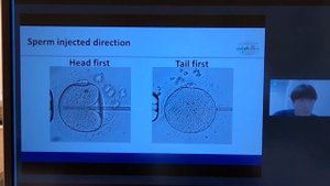 ИКСИ - что делать для увеличения эффективности оплодотворения при ИКСИ