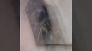Удаление серной пробки из уха...