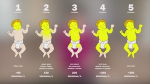 Желтуха новорожденных