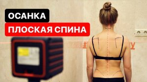 Осанка «Плоская спина» Какие могут быть проблемы из-за такой осанки??