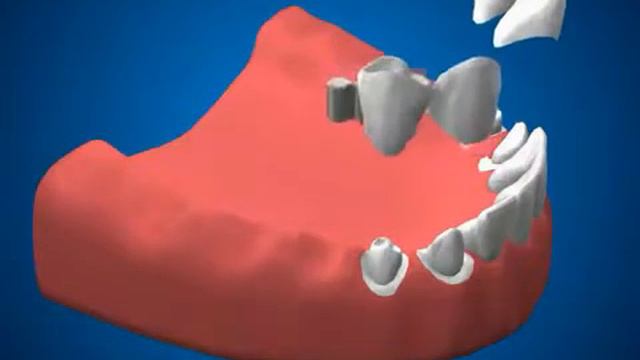 Бюгель на замках avi смотреть онлайн