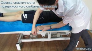 Оценка спастичности поверхностного сгибателя запястья по модифицированной шкале Эшворта