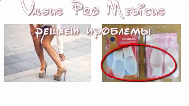 Фиксатор Valgus pro корректор косточки на ноге