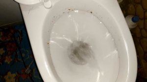 Как прочистить унитаз если засор ( Засор в унитазе )