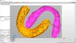 Composer Asiga MAX UV
