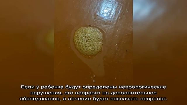 Рвота со слизью у ребенка смотреть онлайн