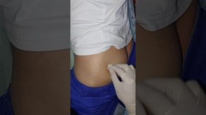 укол в ягодицу видео. Внутримышечная инъекция в ягодичную мышцу