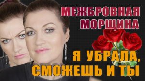 Убираем межбровную морщину! Реально работающее решение!