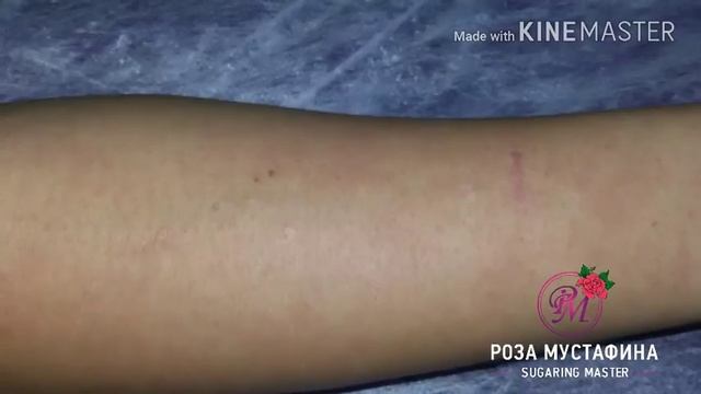 Шугаринг Рук. До и После. смотреть онлайн