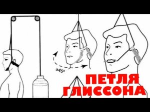 Петля Глиссона - упражнения.