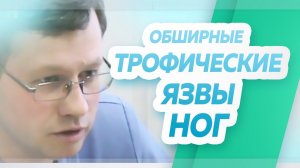 Случай - Обширные трофические язвы нижних конечностей
