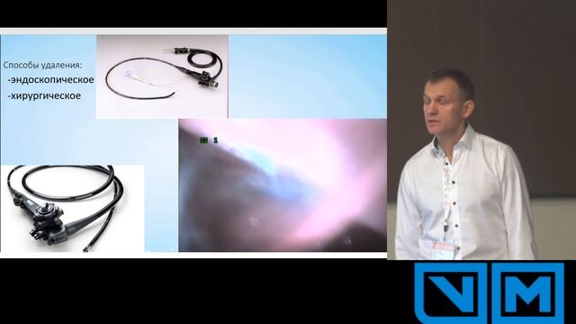 Удаление инородных тел из желудочно кишечного тракта. смотреть онлайн