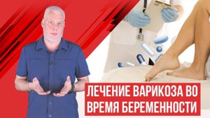 Лечение варикоза беременных