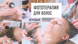 Фототерапия волос в клинике доктора Ведова. Красота волос и молодость кожи