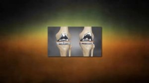 ТОП 5 крутых вещей напечатанных на 3D принтере  Интересные Факты