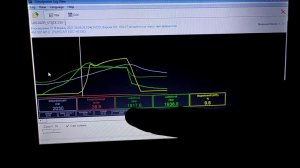 Расшифровка логов AUDI A6 C4 TDI