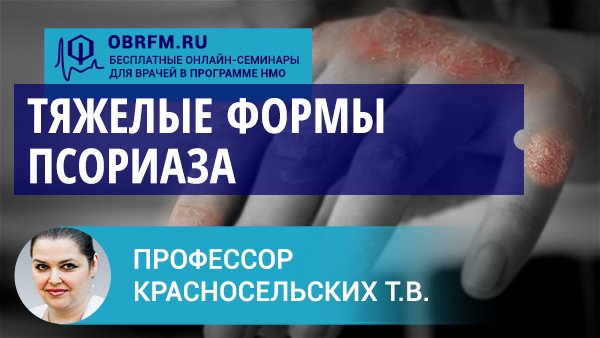 Профессор Красносельских Т.В.: Тяжелые формы псориаза