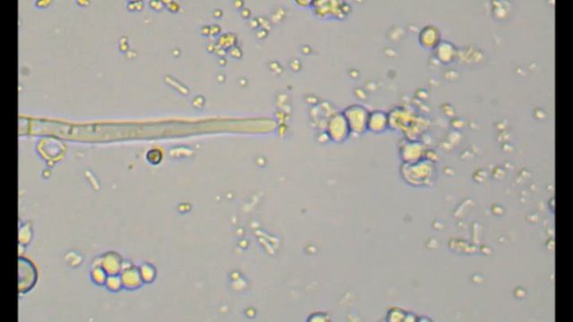 Growing of hyphae and septa formation in Alternaria sp. - fast time lapse
