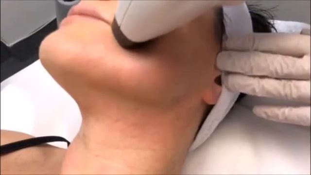 Радиоволновой лифтинг лица в Гродно смотреть онлайн