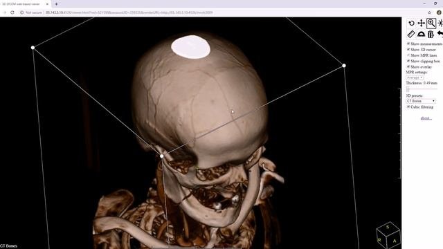 Web-based Viewer