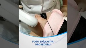 Foto epilyasiya proseduru