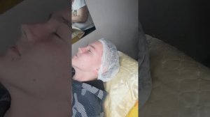 Начинаем экзекуцию) механическая чистка лица #косметолог#аппаратнаякосметология #механическаячистка