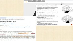 Извращение вкуса