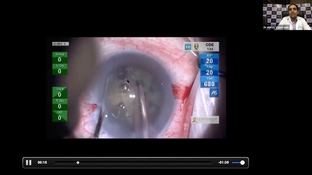 Lecture: Optimizing Cataract Surgical Outcomes in Myriad Situations смотреть онлайн