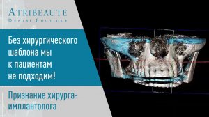Без хирургического шаблона мы к пациентам не подходим! - признание хирурга-имплантолога