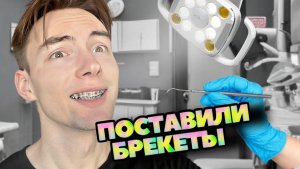 Первые дни с брекетами