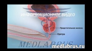 Что такое предстательная железа?