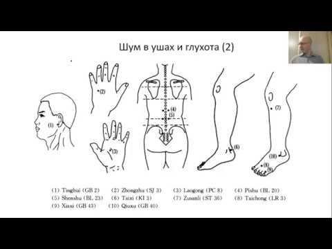 Гоголь И.А. Клиническая акупунктура. Частная патология.