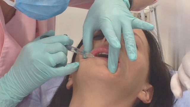 Аириском: студенты учатся. Первая практика - филлеры губы смотреть онлайн