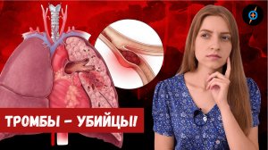 Все о ТЭЛА (тромбоэмболии легочной артерии) - причины, признаки, симптомы, прогноз | Mednavigator.ru
