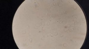 Кровь после бутерброда. ЖЕСТЬ