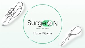 Техника выполнения петли Рёдера