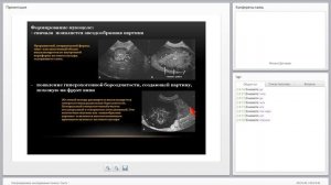 Ультразвуковое исследование печени у животных. Вебинар. Часть 2.  Клиника Котонай.