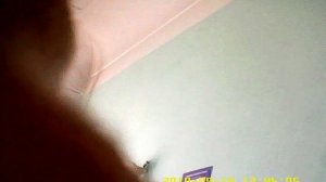 незаконный отказ в бесплатной медицинской помощи неврологом клиники ЦРЛ Мукачева скрытой камерой