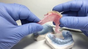 Вместо акрилового протеза термопласт☝