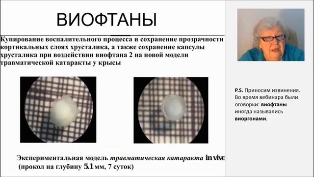 виофтаны | как улучшить зрение | капли для глаз – смотреть онлайн видео ...