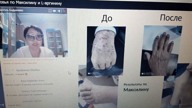 #Аллергия, #атопический #дерматит смотреть онлайн